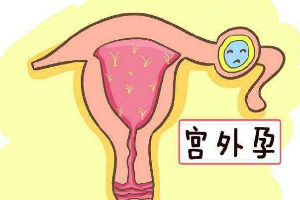 在马来西亚可以选择试管婴儿的性别只是家长需要满足以下条件