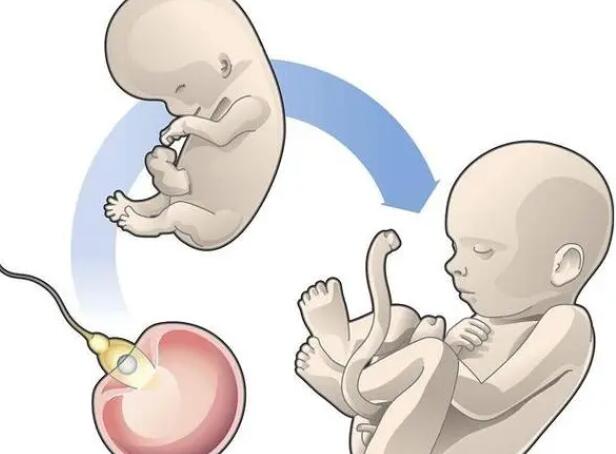 剖析美国试管婴儿双胞胎费用，助孕价格并非1+1=2的事